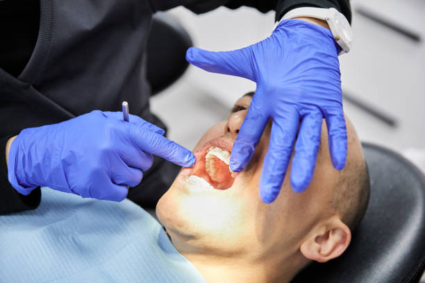 Best Emergency Root Canal Treatment in Janesville, WI