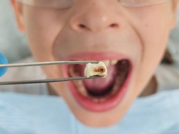 Best Emergency Treatment for Toothache in Janesville, WI